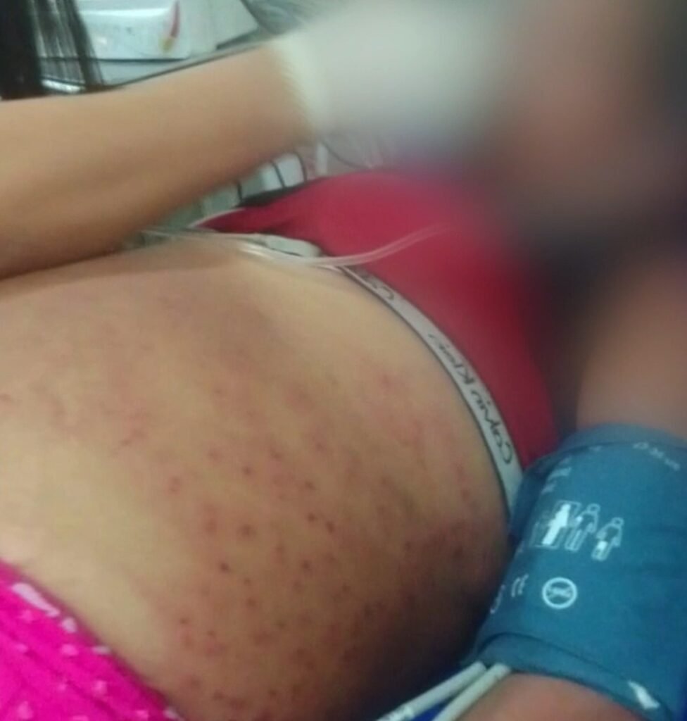 Situação de mulher que levou 1,5 mil picadas de abelhas é grave