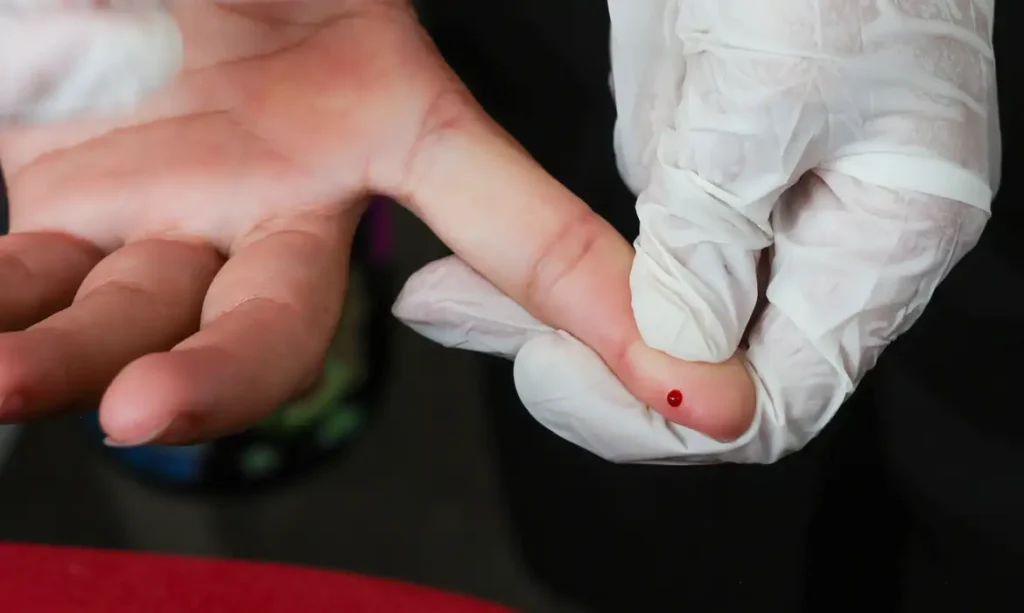 Teste rápido de dengue passa a integrar tabela do SUS